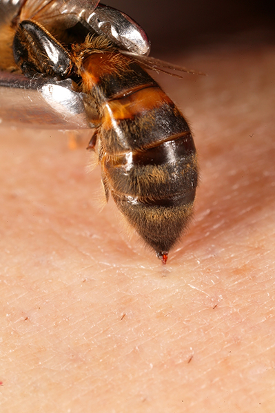 Merchant-and-Makers-Honey-Bees-Eric-Tourneret-27-Api-Acupuncture